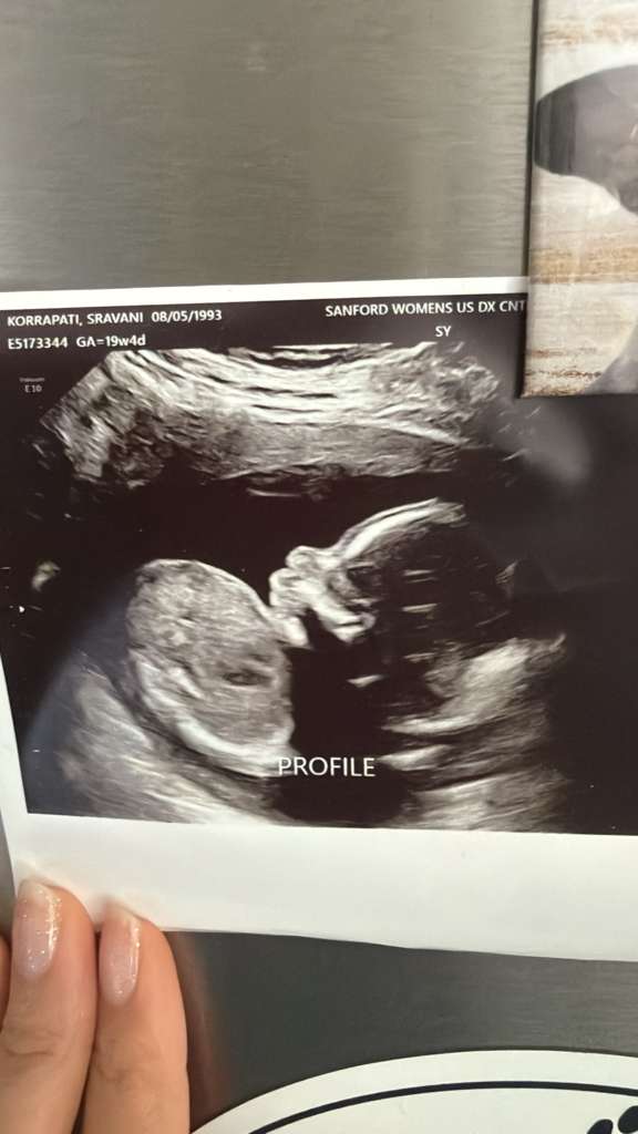 Ultrasound profile